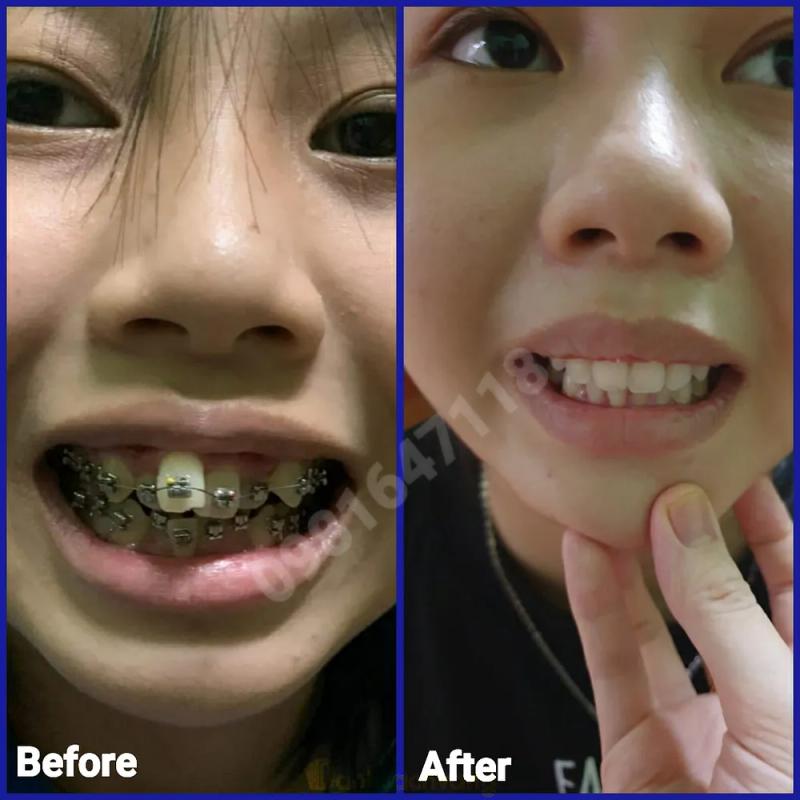 Hình ảnh Nha khoa Nụ Cười Mới: 70 Trần Hưng Đạo, TX. Ayun Pa