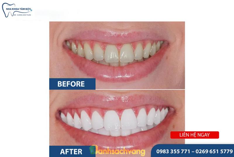 Hình ảnh Nha Khoa Tâm Đức - Bs Tuấn: 852 Hùng Vương, H. Chư Sê