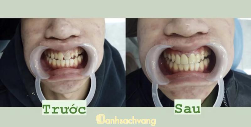Hình ảnh Nha Khoa 3D Bình An: 886 Hùng Vương, H. Chư Sê
