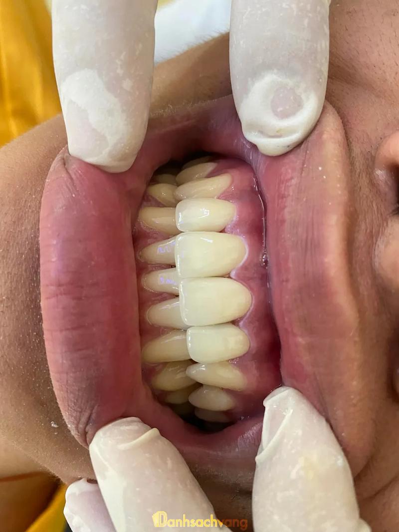 Hình ảnh Nha Khoa Quốc Tế - Chư Sê: 904 Hùng Vương, H. Chư sê
