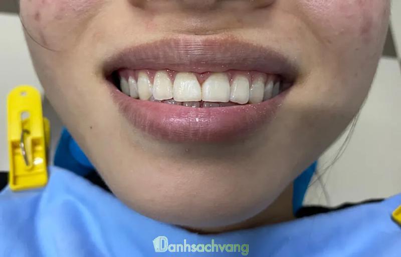 Hình ảnh Nha Khoa Anh Quân: thôn 6, H. Chư Prông