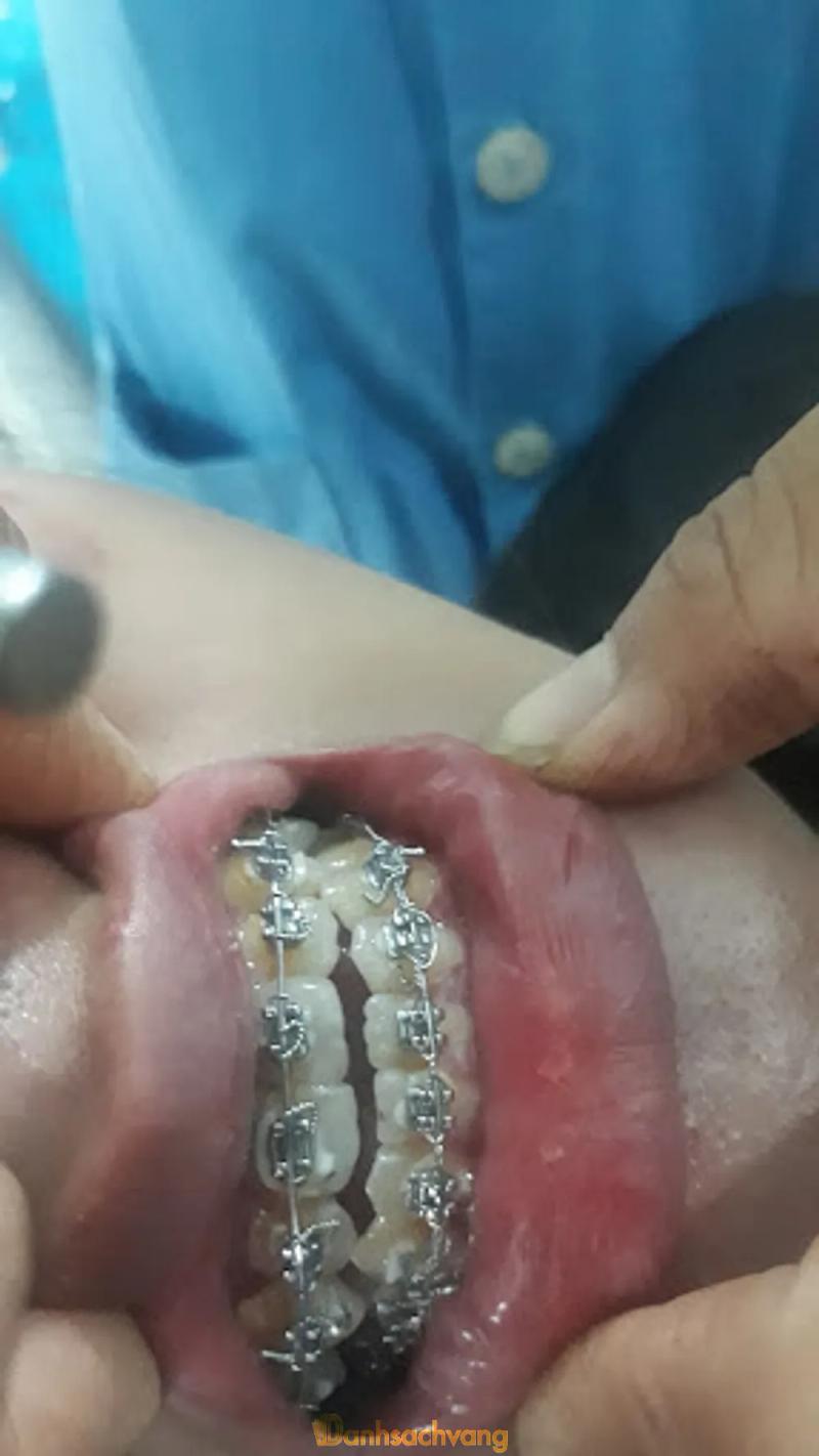 Hình ảnh Nha Khoa Bác Sĩ Chỉ: 36 Phạm Văn Đồng, H. Đức Cơ