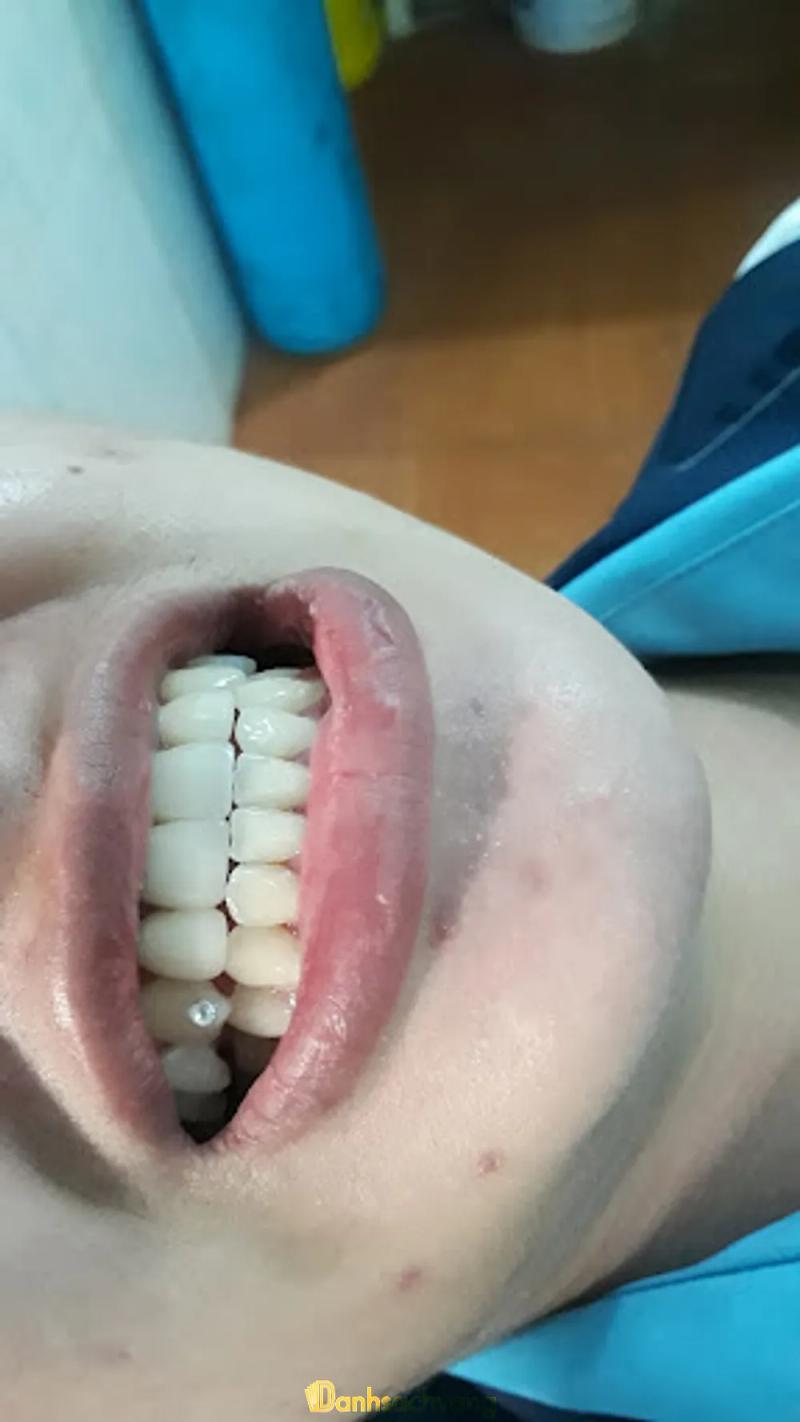 Hình ảnh Nha Khoa Bác Sĩ Chỉ: 36 Phạm Văn Đồng, H. Đức Cơ