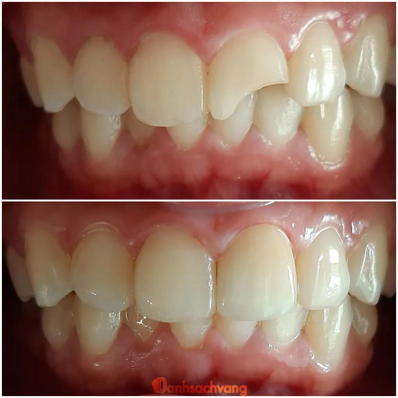 Hình ảnh Nha khoa Anh: 110 Phan Đình Phùng, H. Đức Cơ