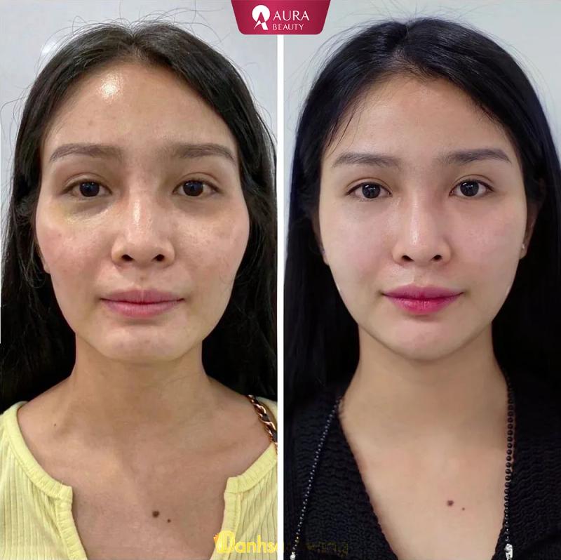 Hình ảnh Aura Beauty: 26B Nguyễn Thái Học, TP. Vinh, Nghệ An