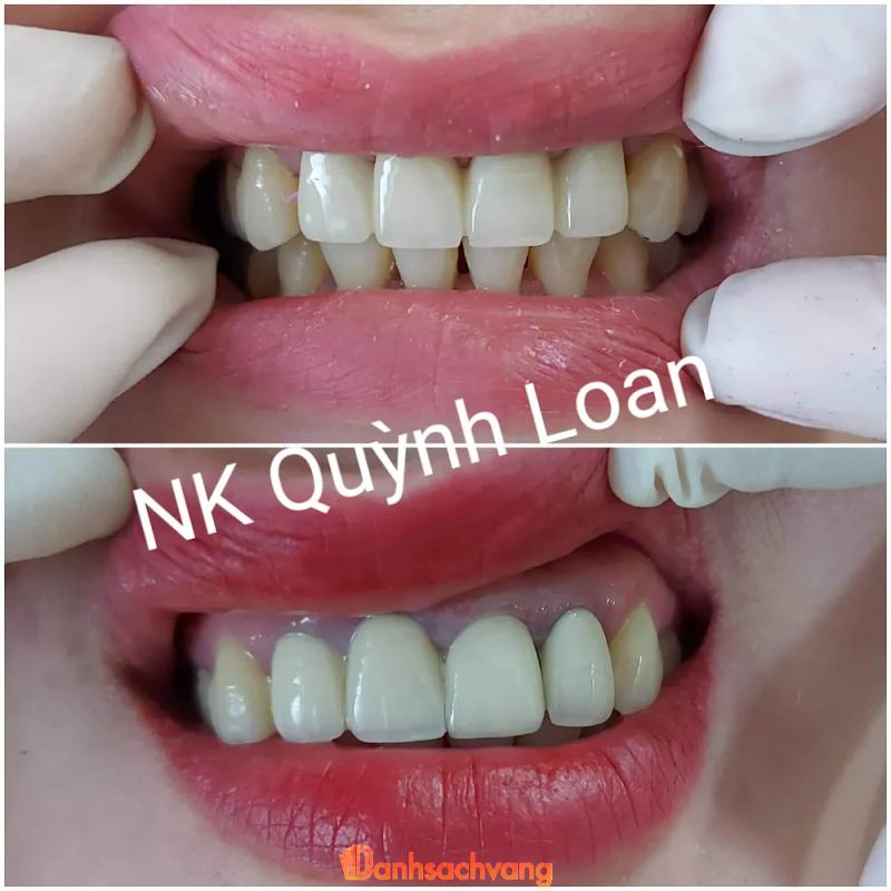 Hình ảnh Nha Khoa Quỳnh Loan: Thôn 6, Bình Hòa, H. Bình Sơn