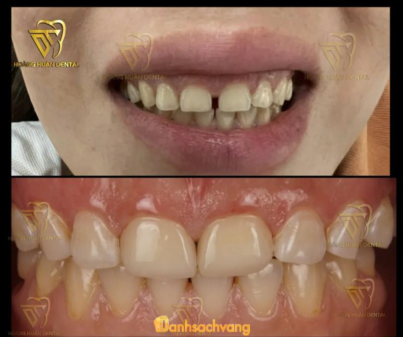 Hình ảnh Nha khoa Hoàng Huân: Thôn 6, QL1A, H. Mộ Đức