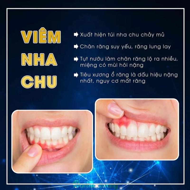 Hình ảnh Nha Khoa Việt Hàn: 333 Nguyễn Văn Linh, H. Sơn Tịnh