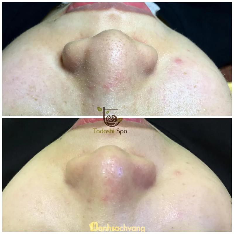 Hình ảnh Spa tadashi: P. Nam Ngạn, TP. Thanh Hóa, Thanh Hóa