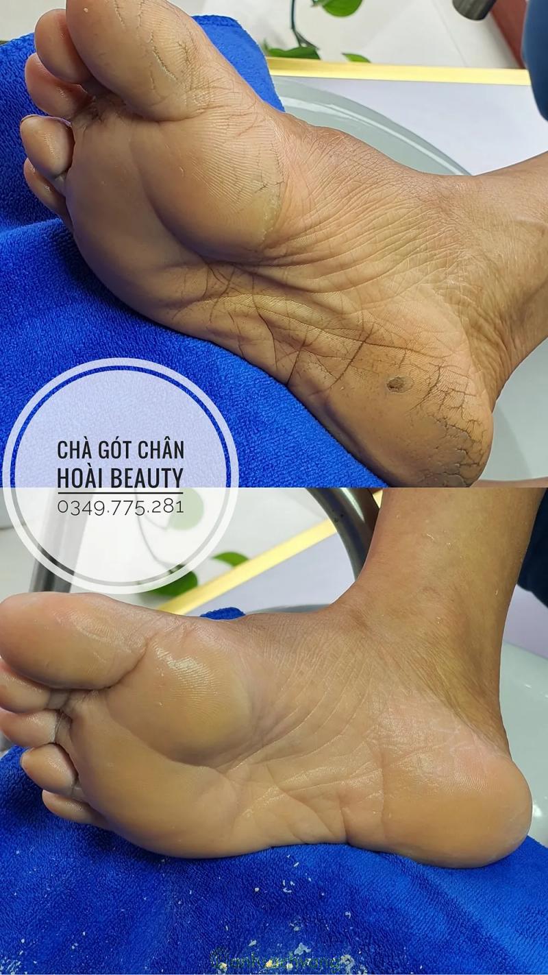 Hình ảnh HOÀI Beauty : Dũng Nhuệ, Duy Nhất, Vũ Thư, Thái Bình