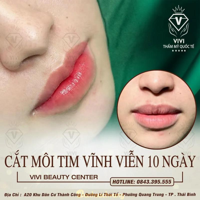 Hình ảnh Thẩm Mỹ Quốc Tế ViVi: 27 P. Bùi Thị Xuân, Thái Bình