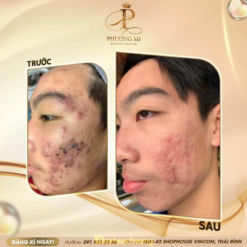 Hình ảnh Spa Phương Mi Thái Bình: 460 Lý Bôn, Thái Bình