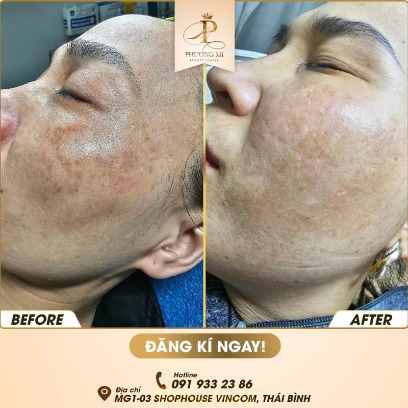 Hình ảnh Spa Phương Mi Thái Bình: 460 Lý Bôn, Thái Bình