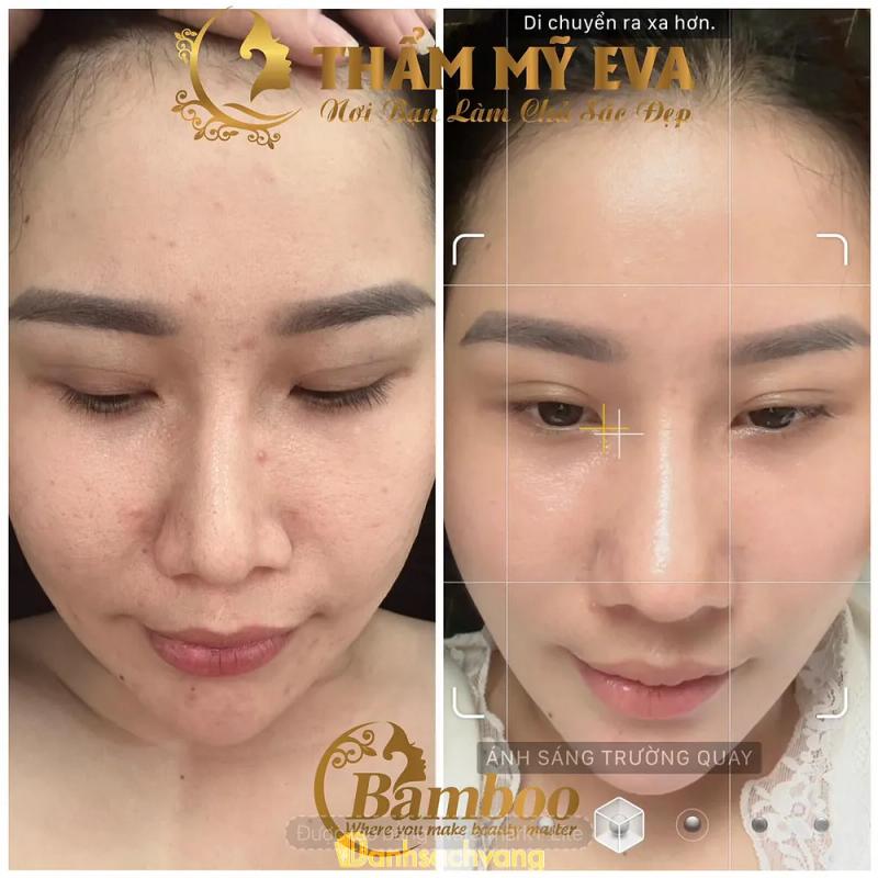 Hình ảnh Thẩm mỹ Eva: 52 - GS24, TP. Dĩ An