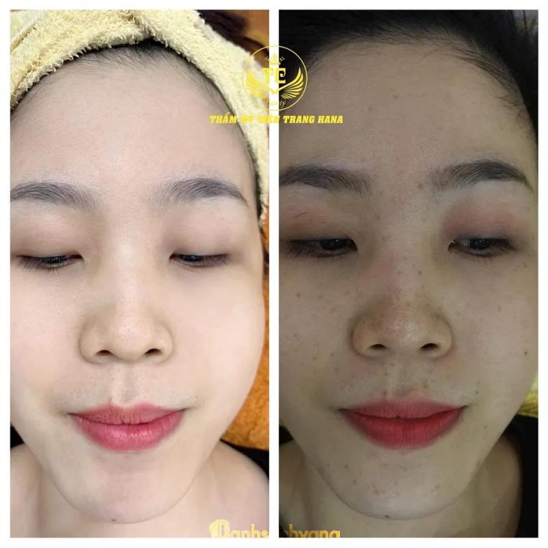 Hình ảnh Thẩm mỹ viện Trang Hana: 1 - D6, TP. Dĩ An 