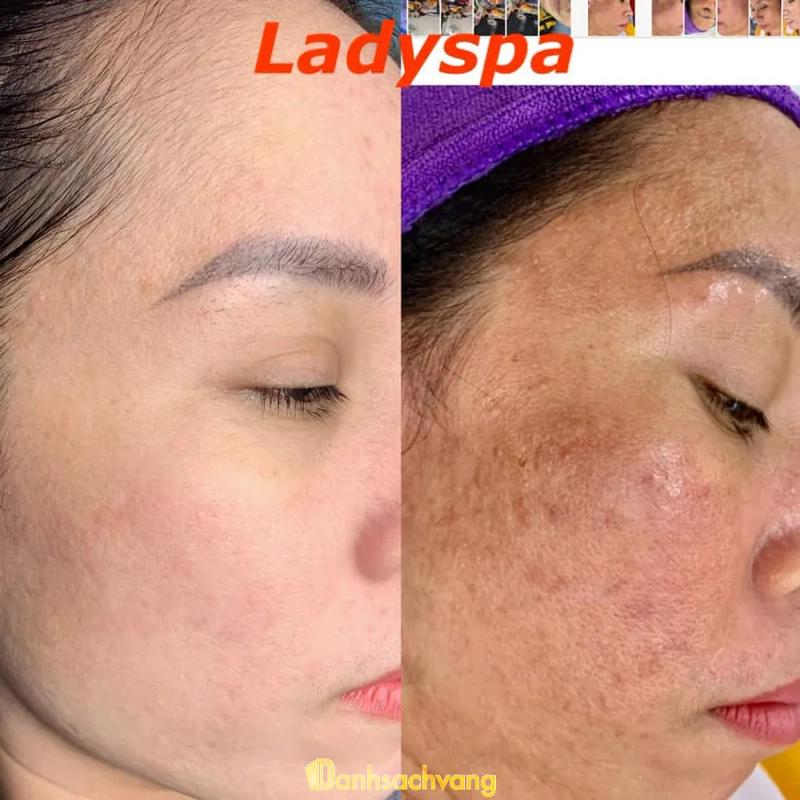 Hình ảnh Lady spa thái bình: 277 Ng. Thì Nhậm, Thái Bình