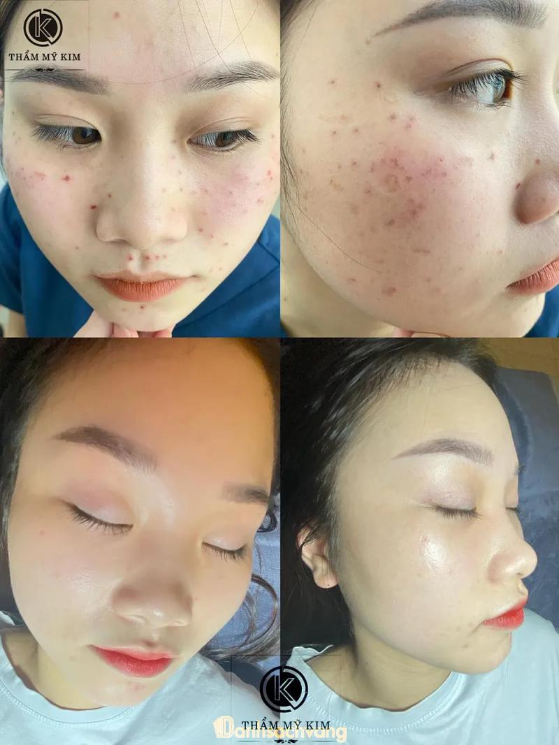 Hình ảnh Kim Spa: 109 Trường Chinh, TP. Nam Định, Nam Định