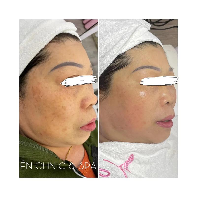 Hình ảnh Én Spa: 555 Trần Hưng Đạo, TP. Nam Định, Nam Định
