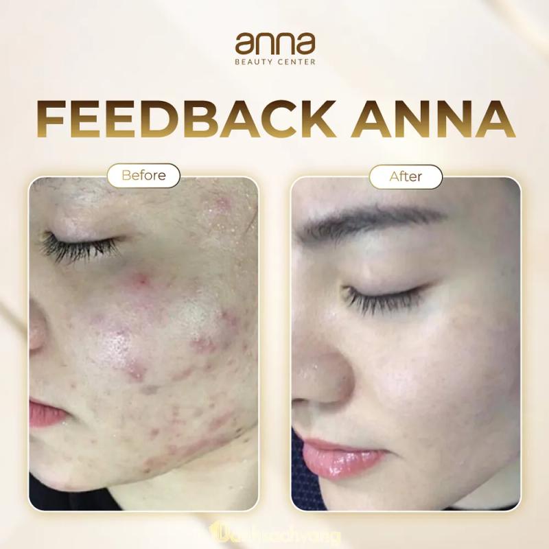 Hình ảnh Anna Beauty Clinic: 128 Đinh Tiên Hoàng, Ninh Bình