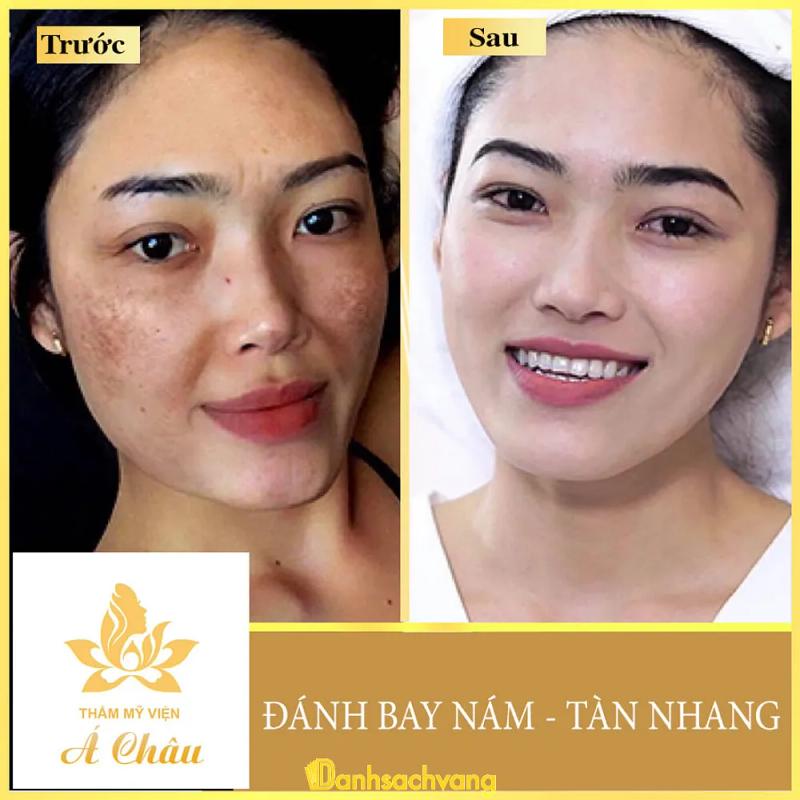 Hình ảnh Thẩm Mỹ Viện Á Châu: 273 Vân Giang, Ninh Bình