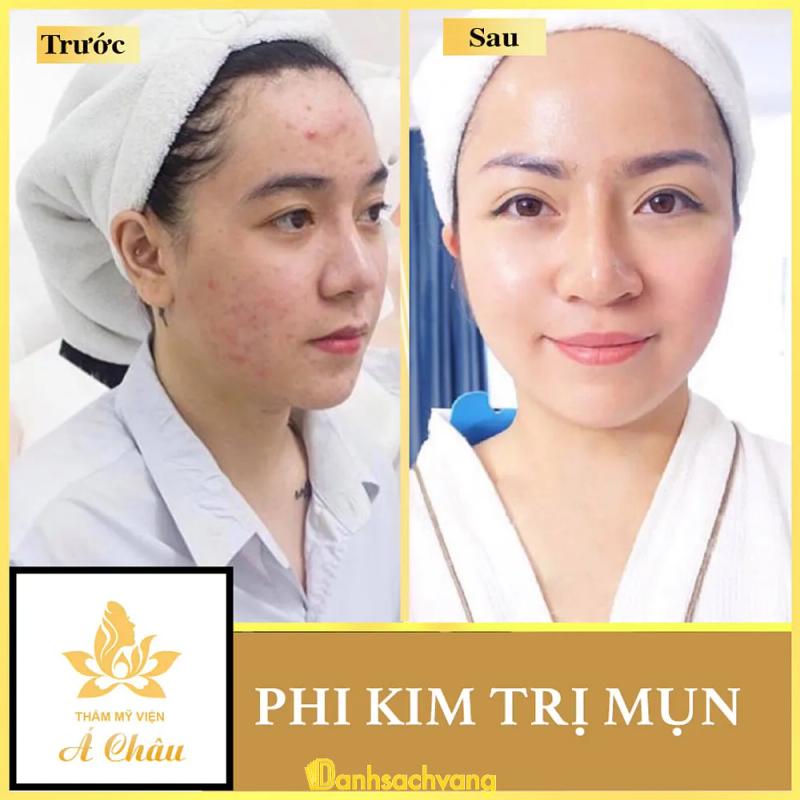 Hình ảnh Thẩm Mỹ Viện Á Châu: 273 Vân Giang, Ninh Bình