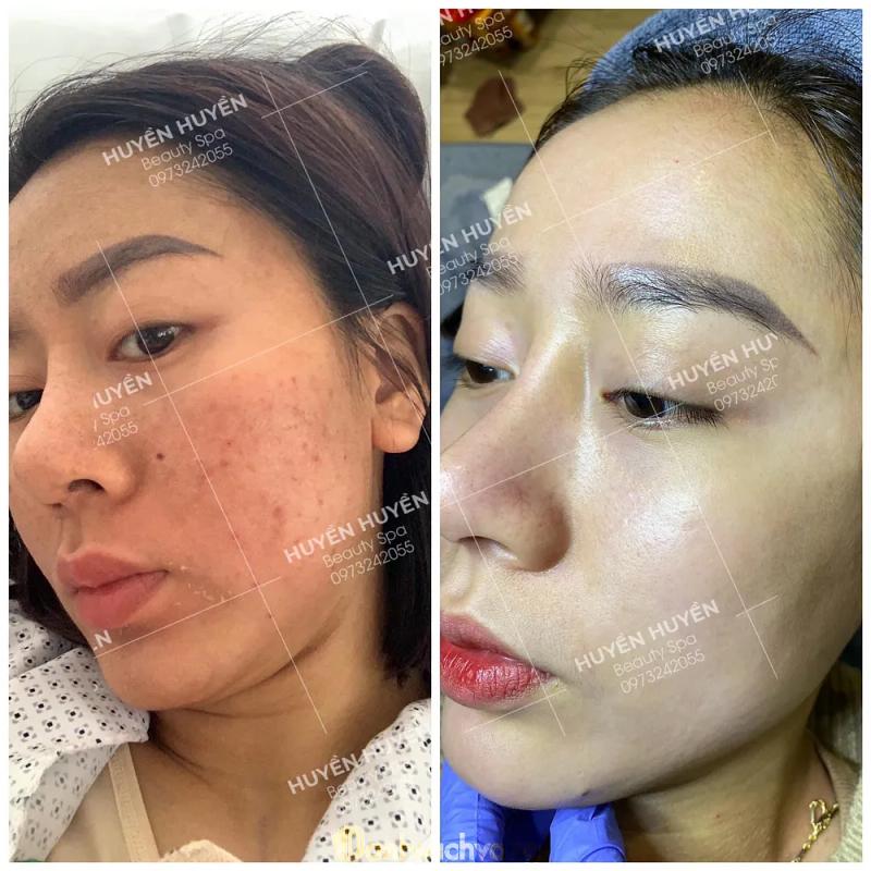Hình ảnh Huyen Lady Spa: 106 Đ. Lê Thánh Tông, Ninh Bình