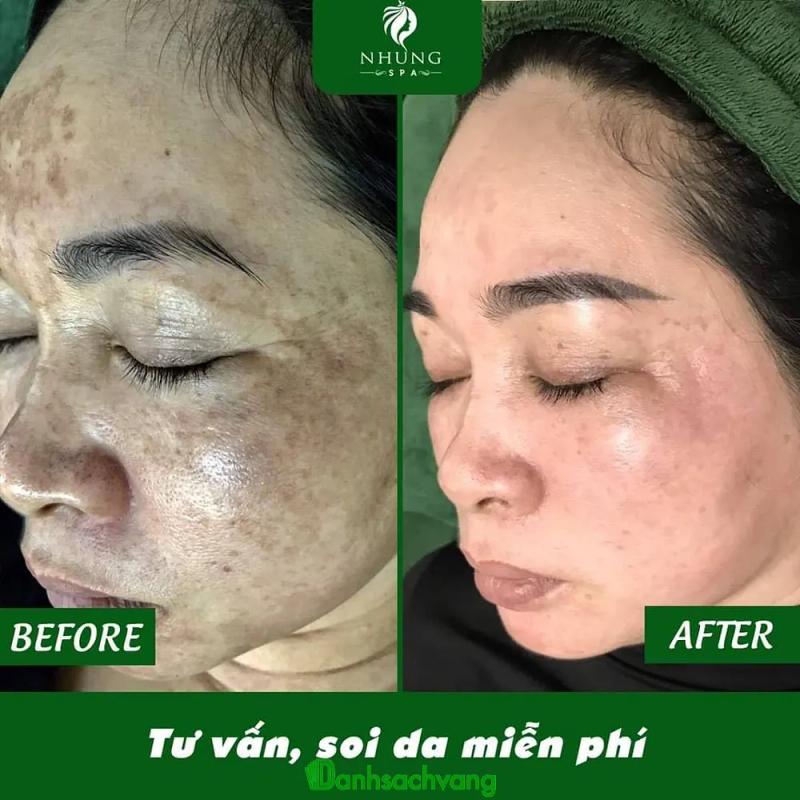 Hình ảnh Nhung Spa: 15A Phố Nguyễn Phúc Lai, Phủ Lý, Hà Nam