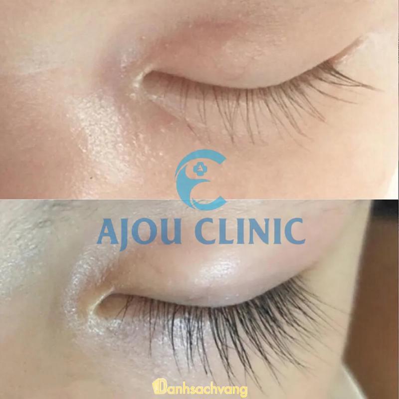 Hình ảnh Thẩm mỹ viện quốc tế AJOU CLINIC: 36 Phõ Nguyễn Quốc Hiệu, Phủ Lý, Hà Nam