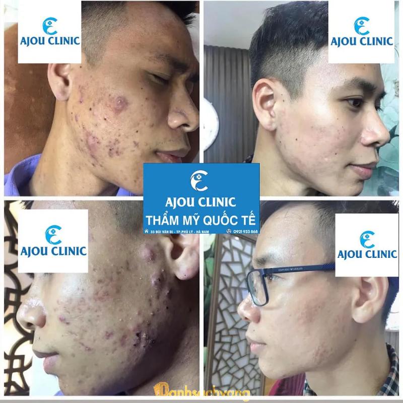 Hình ảnh Thẩm mỹ viện quốc tế AJOU CLINIC: 36 Phõ Nguyễn Quốc Hiệu, Phủ Lý, Hà Nam