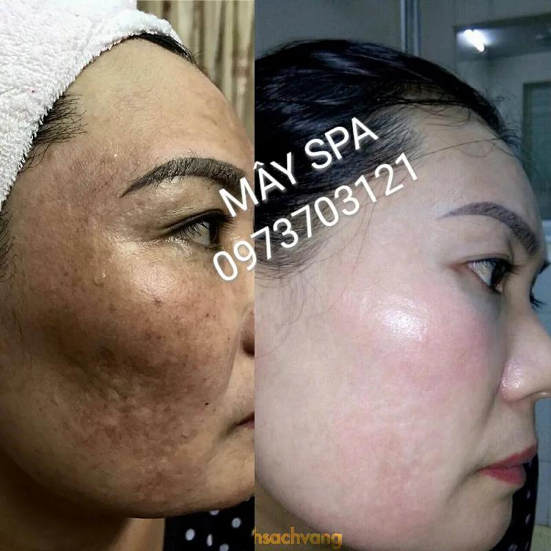 Hình ảnh Mây Spa: HVCJ+24V, Quyển Sơn, Kim Bảng, Hà Nam