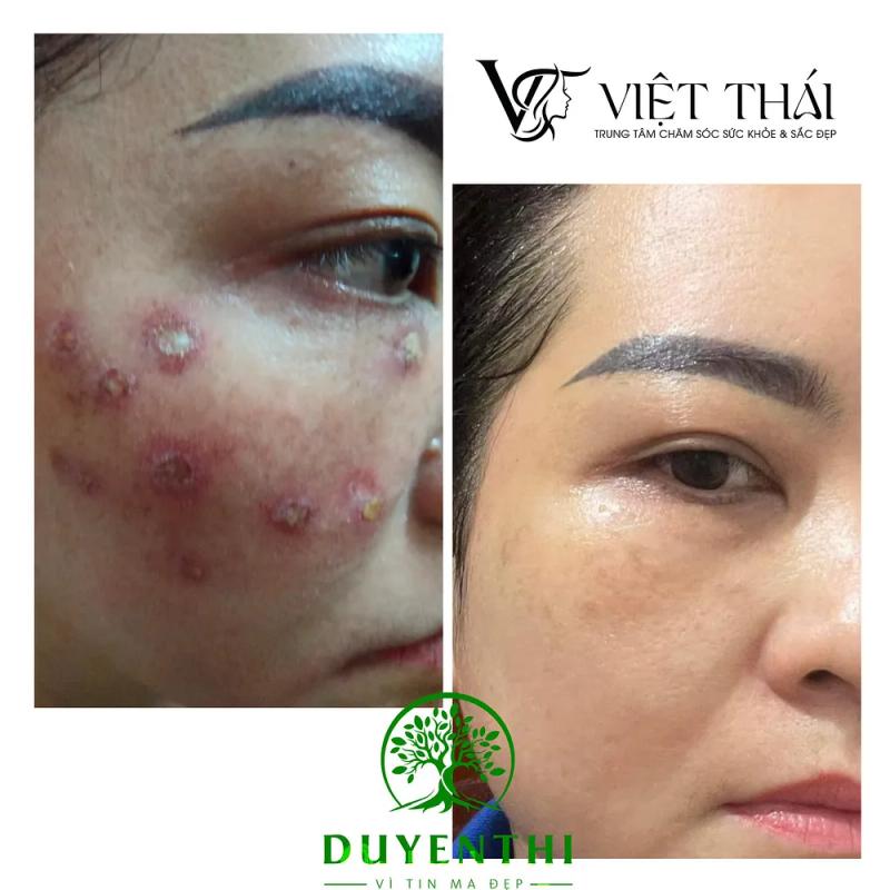 Hình ảnh Thẩm Mỹ Việt Thái: 56 Vũ Quang, Hà Tĩnh