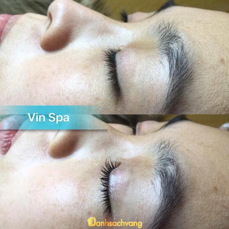Hình ảnh Calla Spa: 60 Nguyễn Công Trứ, P.8, TP. Đà Lạt