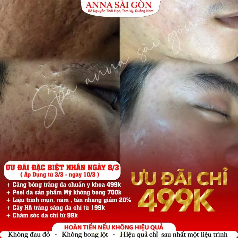 Hình ảnh Anna Spa: 10c Lê Lợi, Phường An Mỹ, TP Tam Kỳ