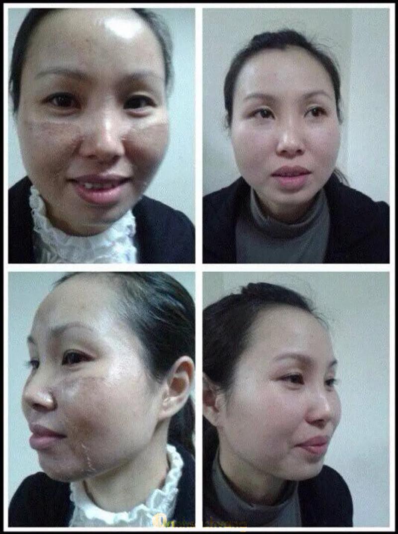 Hình ảnh Spa Bích Ngọc: Hùng Vương, Trần Phú, Móng Cái
