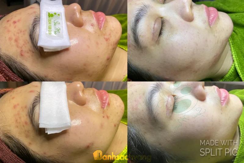 Hình ảnh Mộc Beauty Spa: 21/15 Nguyễn An Ninh, TP Mỹ Tho