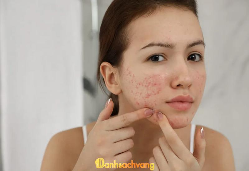 Hình ảnh 5 Địa chỉ trị sẹo, thâm tại Đắk Lắk uy tín, an toàn