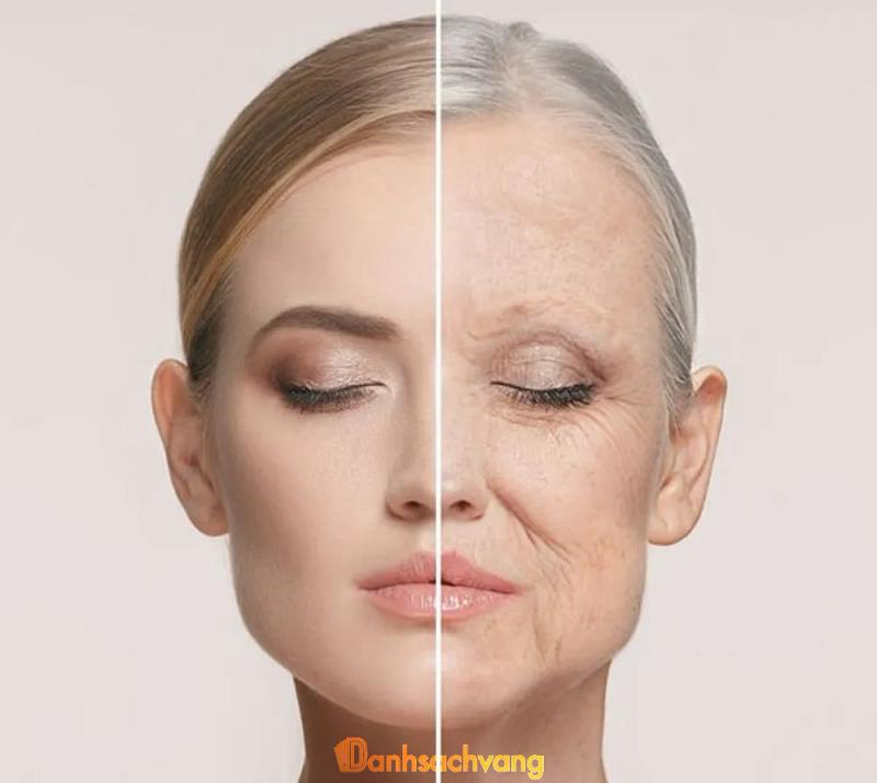 Hình ảnh 10 Địa chỉ nâng cơ mặt xoá nhăn tại TPHCM chất lượng nhất