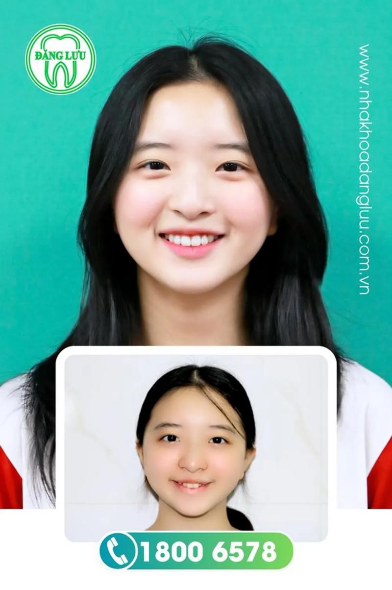 Hình ảnh Nha Khoa Đăng Lưu: 34 Phan Đăng Lưu, Q. Bình Thạnh