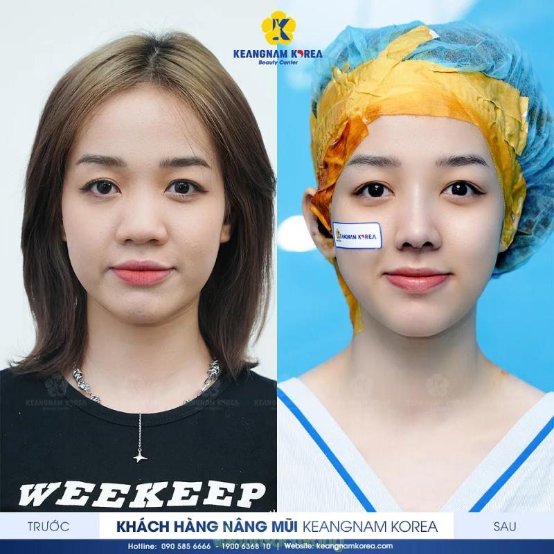Hình ảnh Keangnam Korea Beauty Center: 394 Cao Thắng, Q. 10