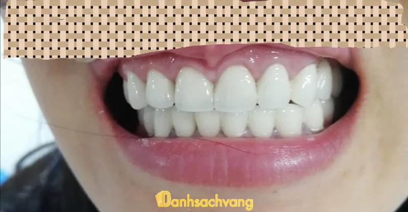 Hình ảnh Nha Khoa Trâm Anh: 26 Hùng Vương, Trà Vinh