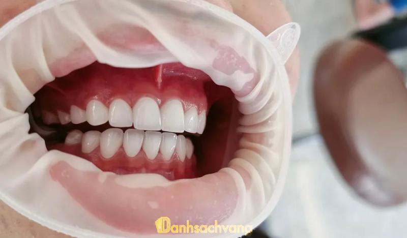 Hình ảnh Nha Khoa Trâm Anh: 26 Hùng Vương, Trà Vinh