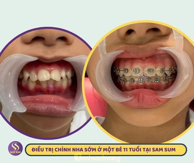 Hình ảnh Nha Khoa Trà Vinh: Khu nhà phố Vincom, Trà Vinh