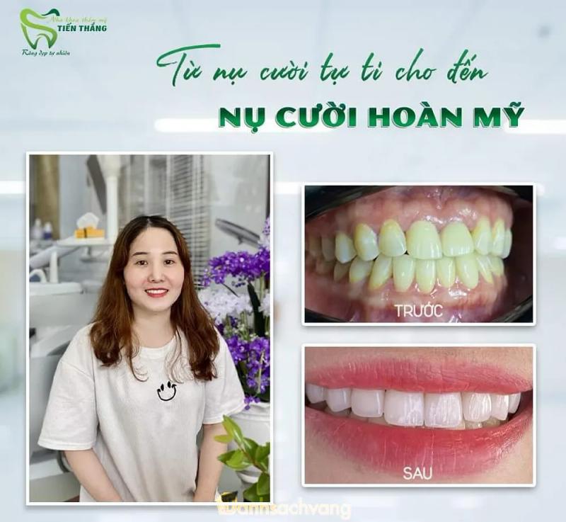 Hình ảnh Nha khoa Tiến Thắng: QL 7B, khối 1, TT. Yên Thành, Nghệ An