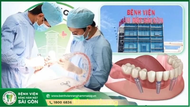 Hình ảnh Cấy implant tại bệnh viện răng hàm mặt sài gòn