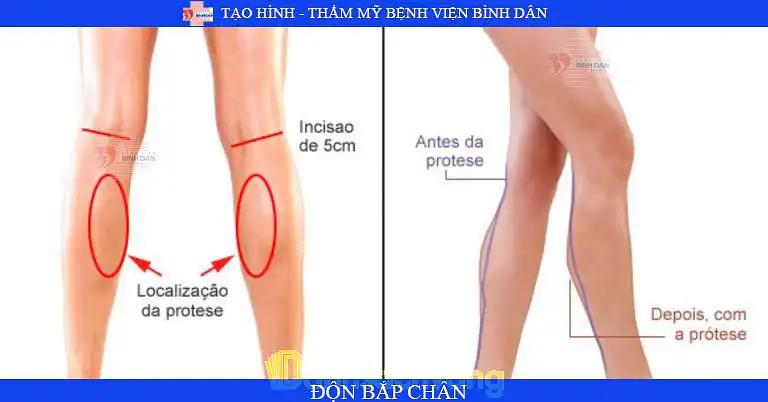 Hình ảnh Khoa Phẫu Thuật Tạo Hình Thẩm Mỹ - Bệnh viện Bình Dân: 371 Điện Biên Phủ, Quận 3