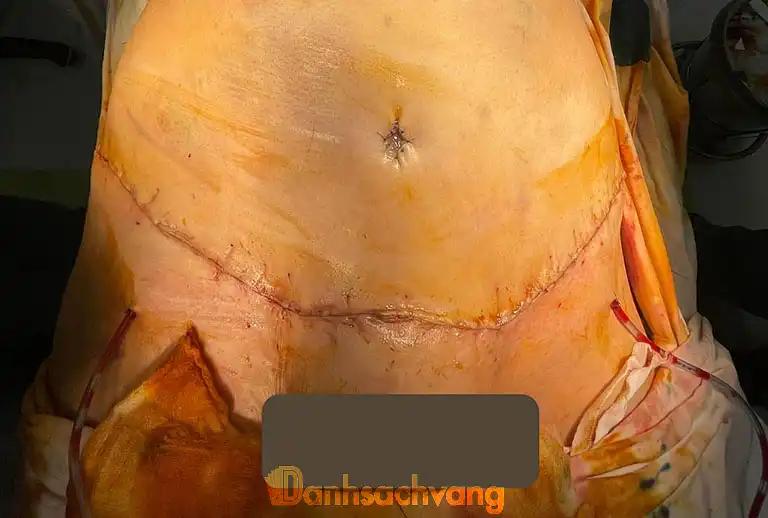 Hình ảnh Khoa Phẫu Thuật Tạo Hình Thẩm Mỹ - Bệnh viện Nguyễn Tri Phương