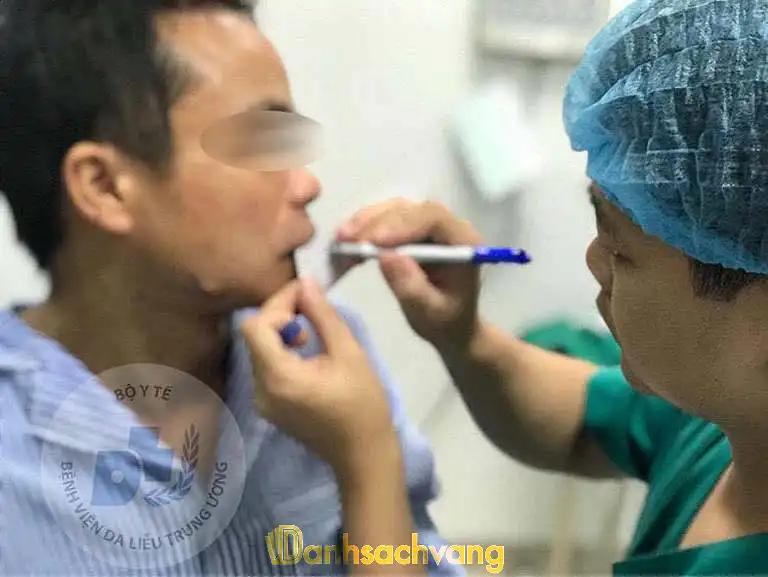 Hình ảnh Khoa Phẫu thuật Tạo hình Thẩm mỹ và PHCN - Bệnh viện Da Liễu Trung Ương