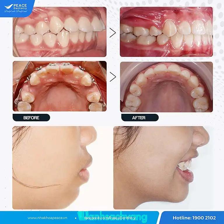 Hình ảnh Nha khoa Peace Dentistry cn Quận 10: 328 Nguyễn Chí Thanh, Quận 10