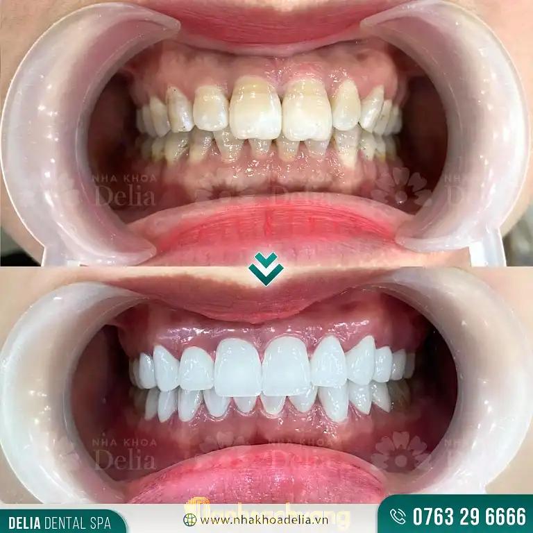 Hình ảnh Nha Khoa Thẩm Mỹ Quốc Tế Delia: KĐT Hà Đô Centrosa Garden, Quận 10