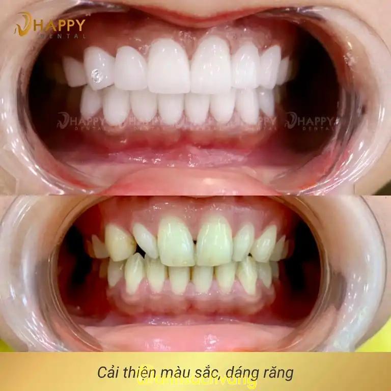 Hình ảnh Nha Khoa Happy Smile: 106 Trần Bình Trọng, Quận 5